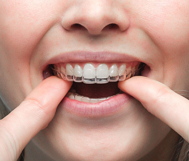 airsmile