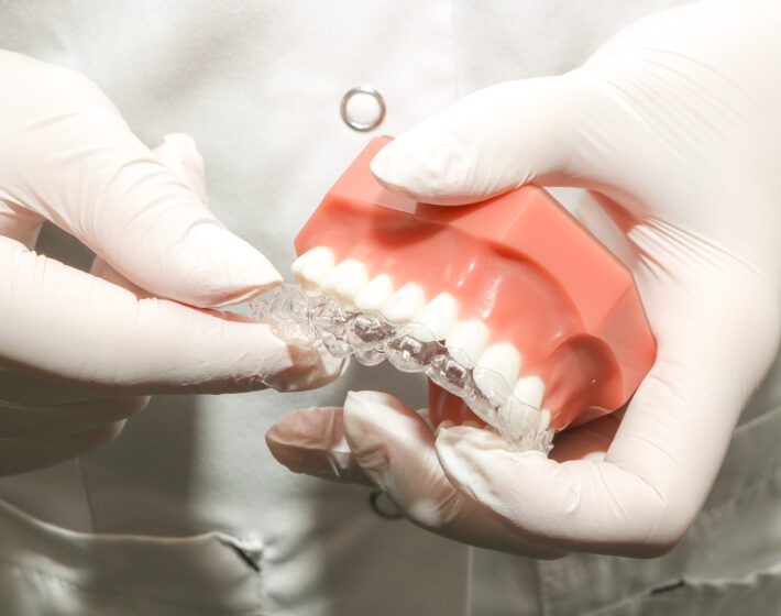 orthodontist-de-meern-13